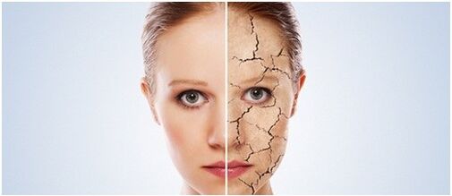 We treat psoriasis